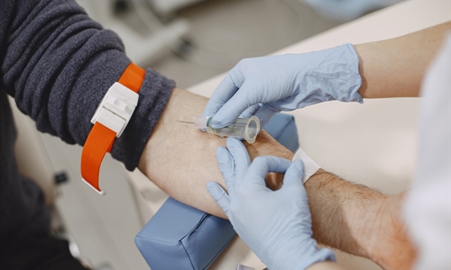 Apel iz transfuzijske službe