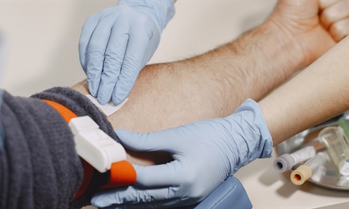 Upute HZMO-a zbog poskupljenja police dopunskog osiguranja HZZO-a