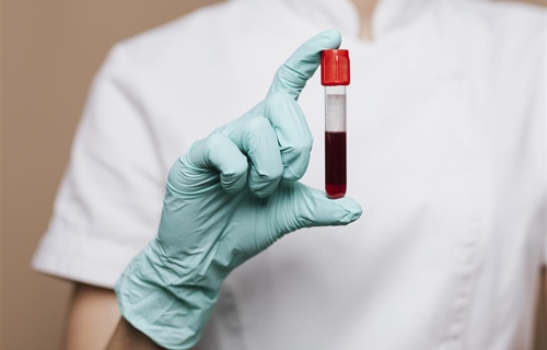 Na zagrebačkom Vrhovcu otvoreno prihvatilište za onkološke bolesnike