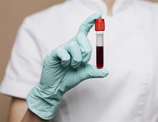 Nova dijagnostička metoda: U KB Dubrava analiza mitohondrijskog genoma