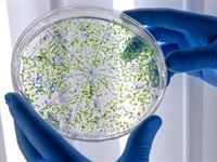Ljetne vrućine povećavaju rizik od trovanja hranom: Epidemiolog...
